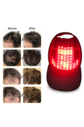 Casque LED Capillaire Pro™ | Stimule la Pousse et Renforce Vos Cheveux