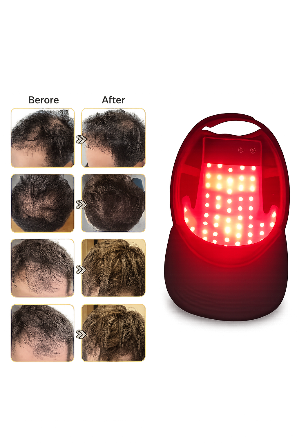 Casque LED Capillaire Pro™ | Stimule la Pousse et Renforce Vos Cheveux
